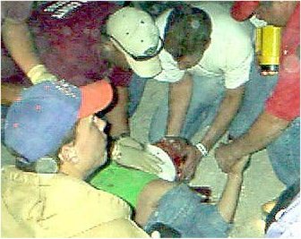 Violence in the pits